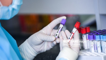 Ulaanbaatar [Total COVID-19 cases exceed 60 thousand in Mongolia, with 1.3 million people fully vaccinated]